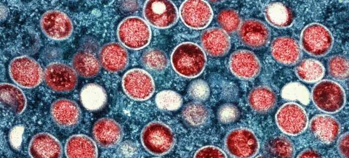 Imagem colorida de microscopia eletrônica de transmissão de partículas do vírus mpox (vermelho), encontradas dentro de uma célula infectada (azul), que foi cultivada em laboratório